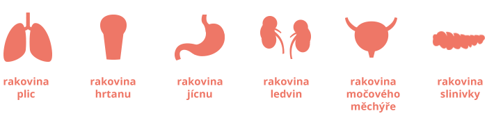 Rakovina – plic, jícnu, hrtanu, ledvin, močového měchýře, slinivky a dalších orgánů